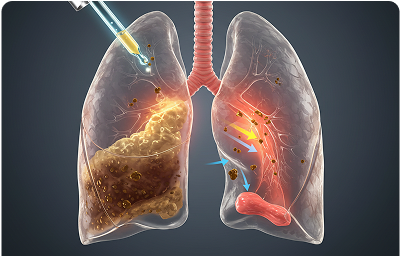 Clear Airways Illustration